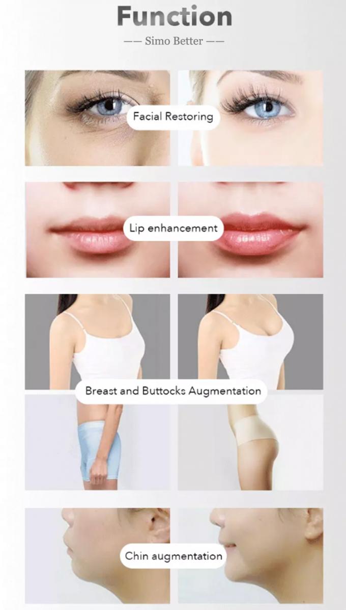 ナトリウムのHyaluronateの注射可能な皮膚注入口の非外科唇の強化のゲル