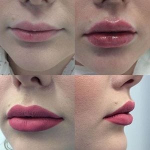 美の安全唇の増加の注入口の液体のゲルの化粧品の唇の注入